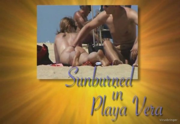 Itsmee's Sunburned in Playa Vera